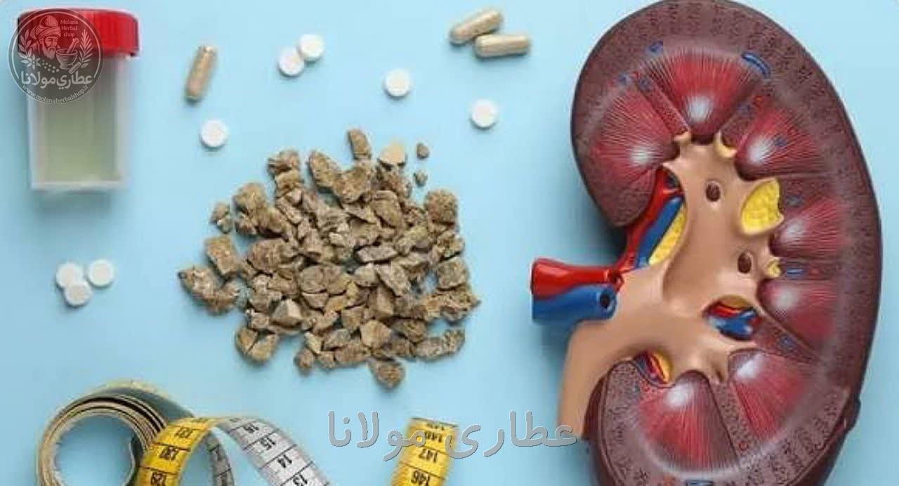  شکستن سنگ کلیه ۱